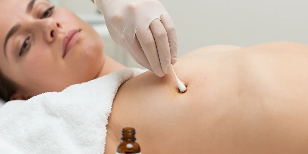 nombril sale qui pue